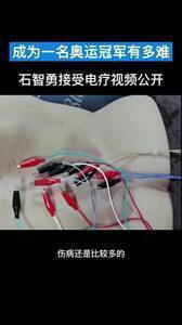 看看石智勇接受电疗的视频 你就明白成为一名奥运冠军有多难！